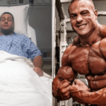 How did Professional Bodybuilder Evan Centopani Tear his Quads?