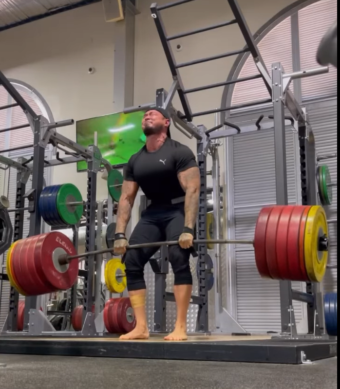 Bilateral Quad Tendon Tear Patella Rupture Recovery – 660 lbs. Deadlift